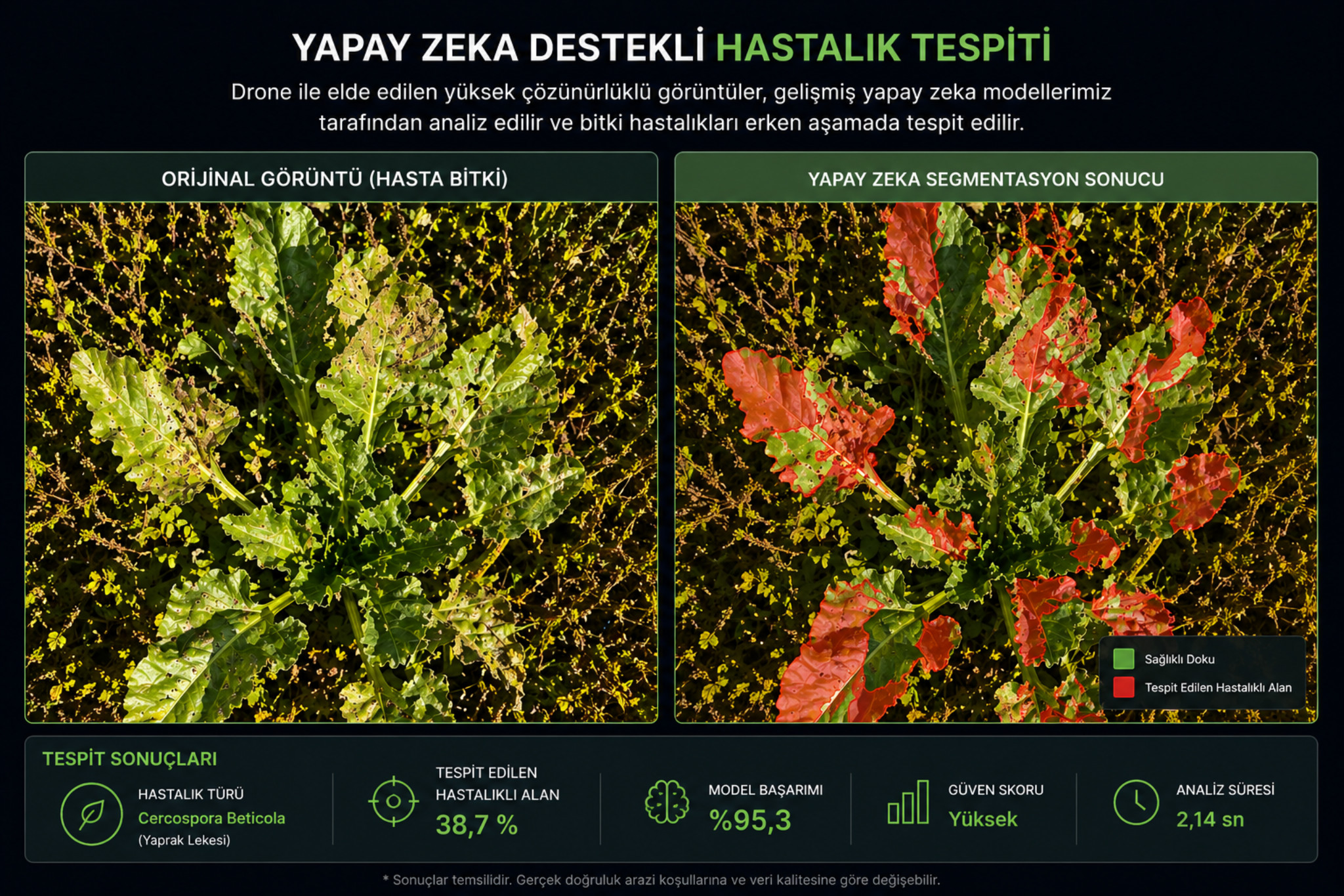 Yapay zeka destekli hastalık tespiti segmentasyon çıktısı